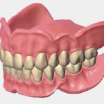Dentures – All You Need to Know about