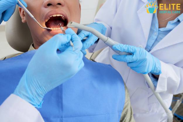 Dental Surgery Service in Tracy CA – Elite Dental Care Tracy