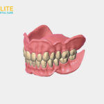 The New Denture Care Instructions and Tips – Elite Dental Care Tracy