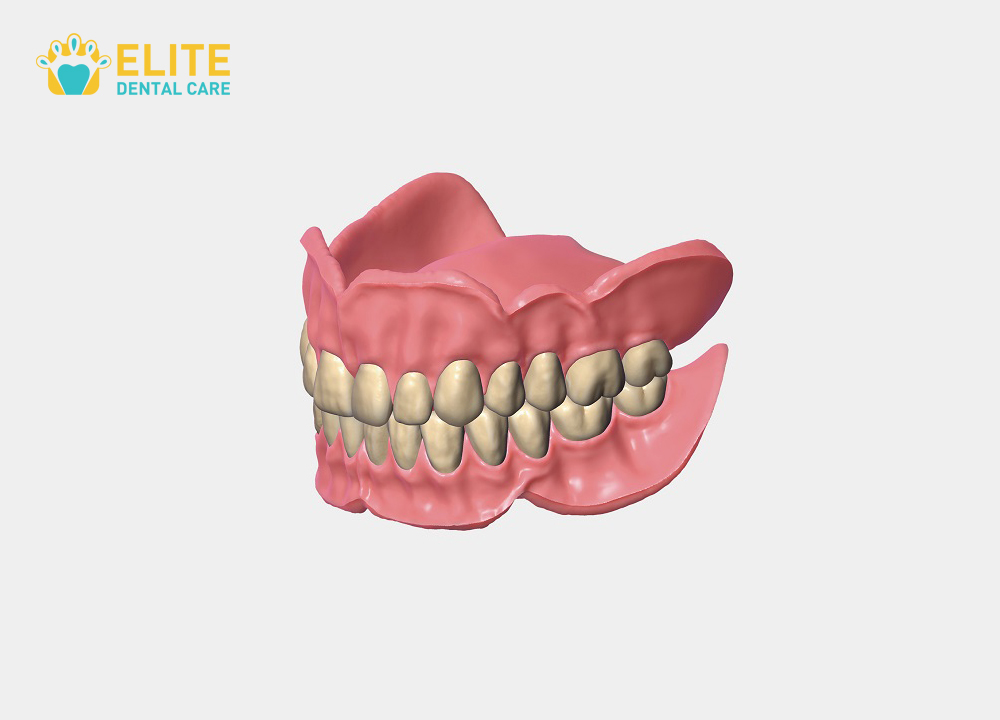 The New Denture Care Instructions and Tips – Elite Dental Care Tracy