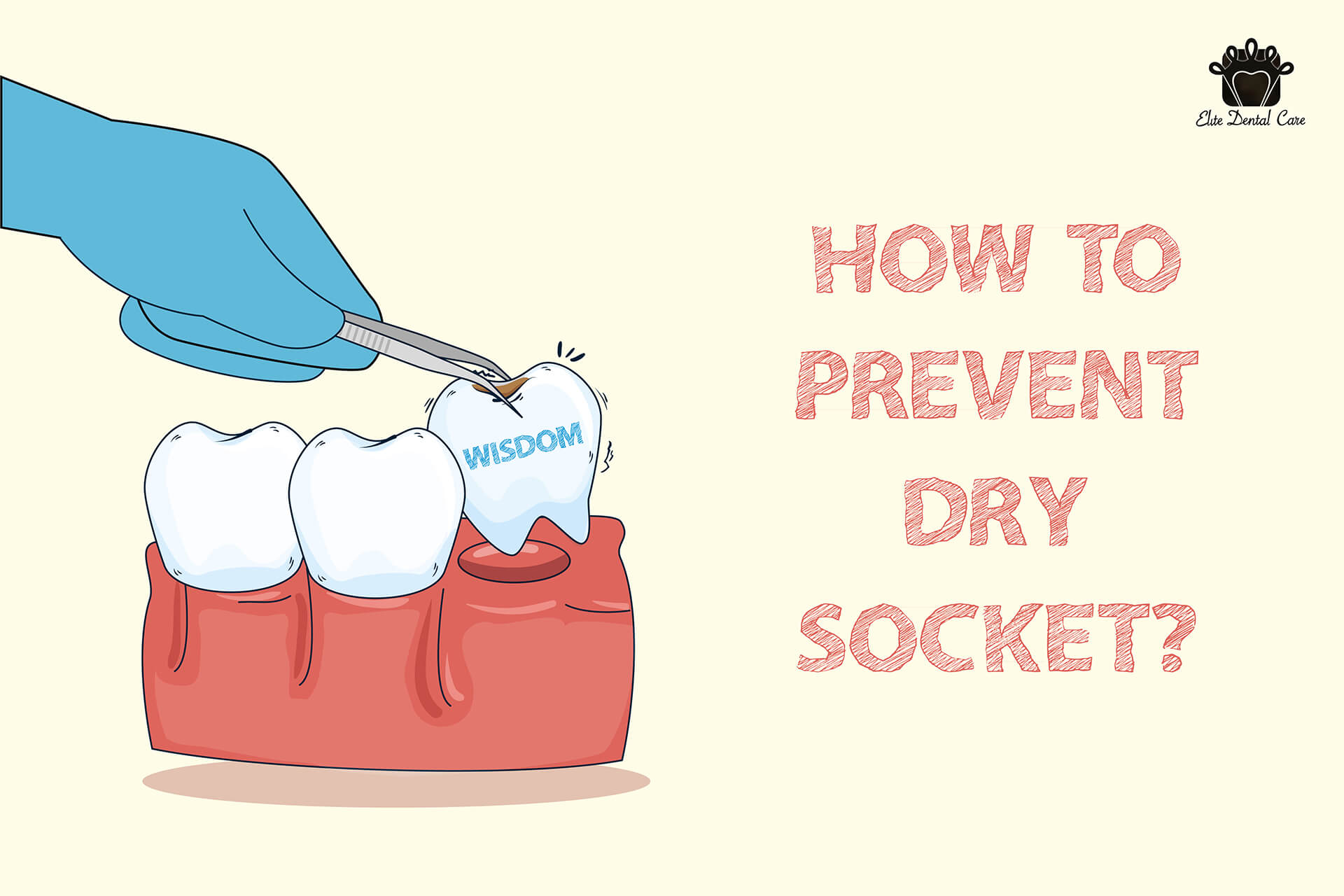 Pulled Out Wisdom Teeth? How to Prevent Dry Socket – Elite Dental Care Tracy