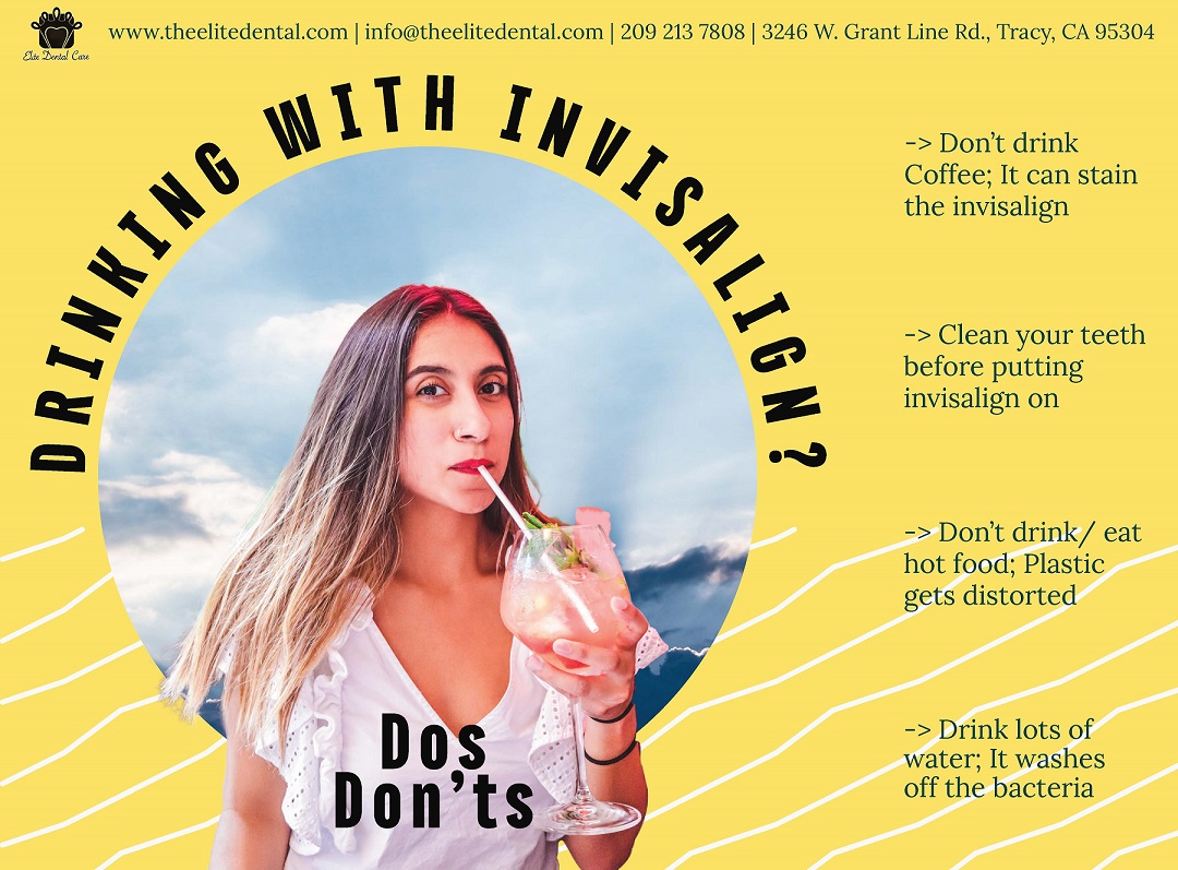DOs AND DON’Ts WHILE DRINKING WITH INVISALIGN – ELITE DENTAL CARE TRACY