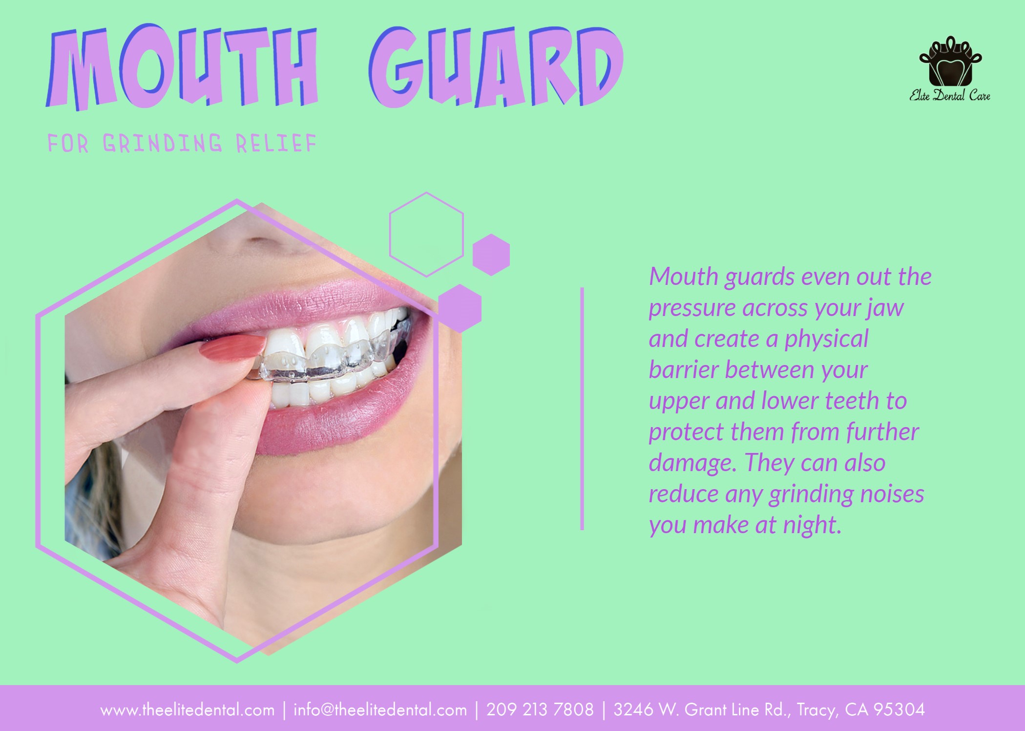 MOUTHGUAD FOR TEETH GRINDING – ELITE DENTAL CARE TRACY