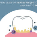 WHAT LEADS TO DENTAL PLAQUE FORMATION & HOW TO PREVENT IT? – ELITE DENTAL CARE