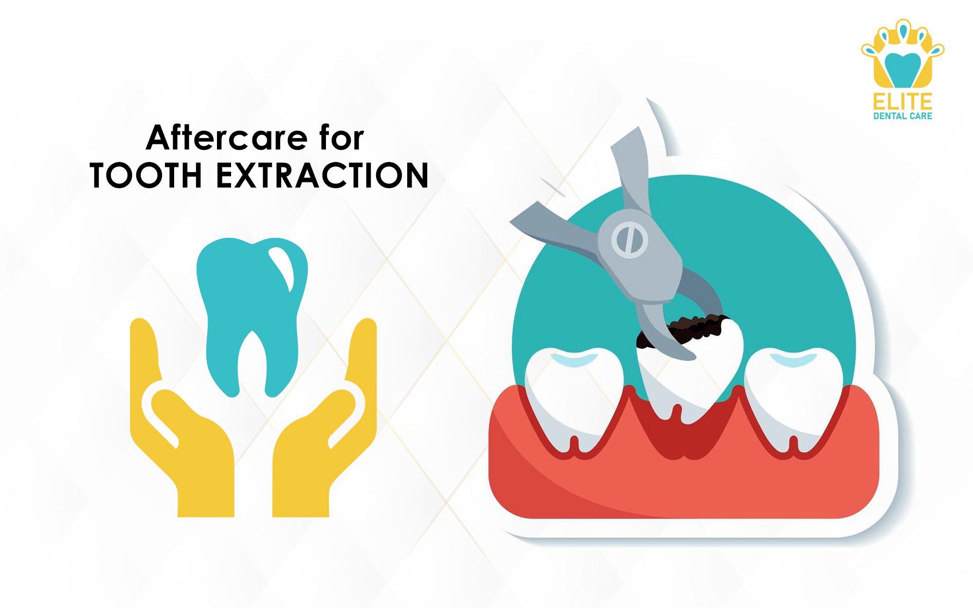 AFTERCARE FOR TOOTH EXTRACTION – ELITE DENTAL CARE TRACY