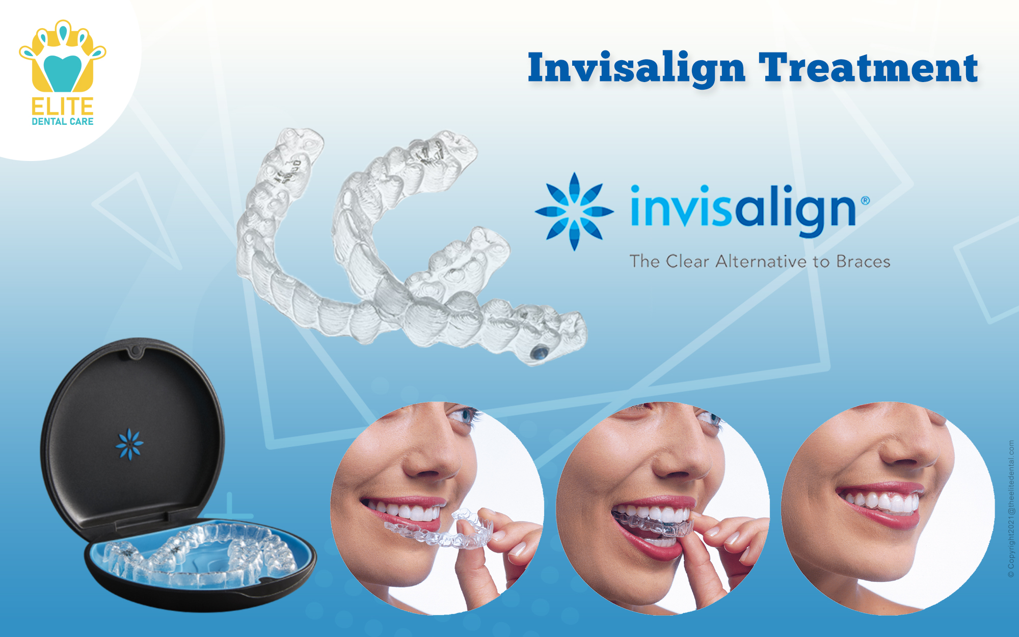 Invisalign Treatment: Everything You Need to Know
