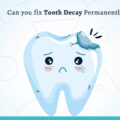 Can you fix Tooth Decay Permanently?