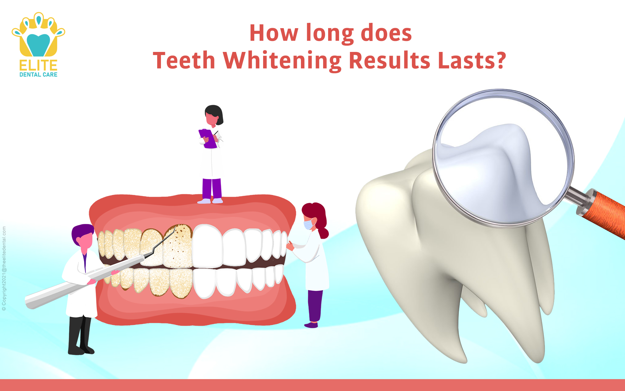 How Long Do Teeth Whitening Results Last?