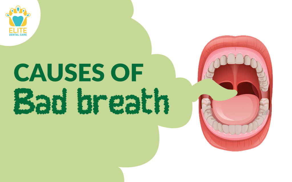 What are the Main Causes of Bad Breath? Elite Dental Care