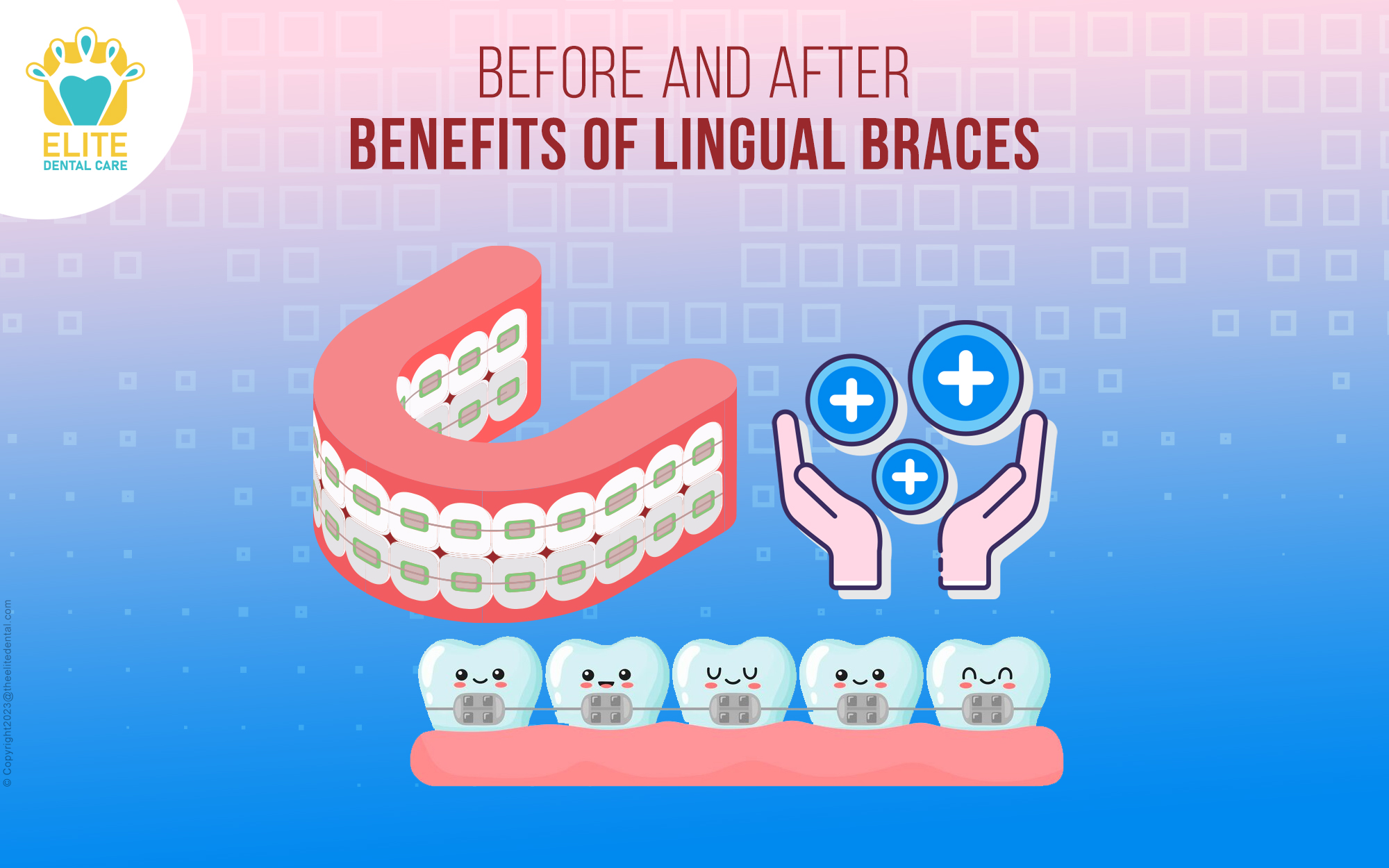 Before and after benefits of lingual braces
