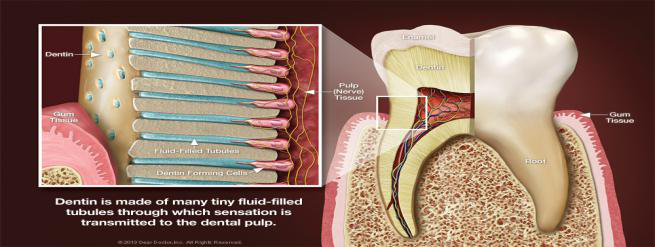 Exposure of Dentin Layer
