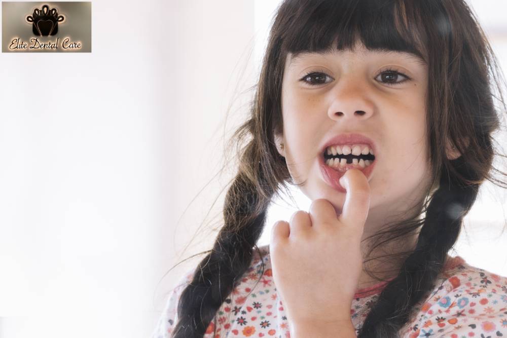 Broken or chipped tooth is observed very rarely, it does not cause any pain, unless the damage is very deep enough to expose the tissues of inner layer of tooth.