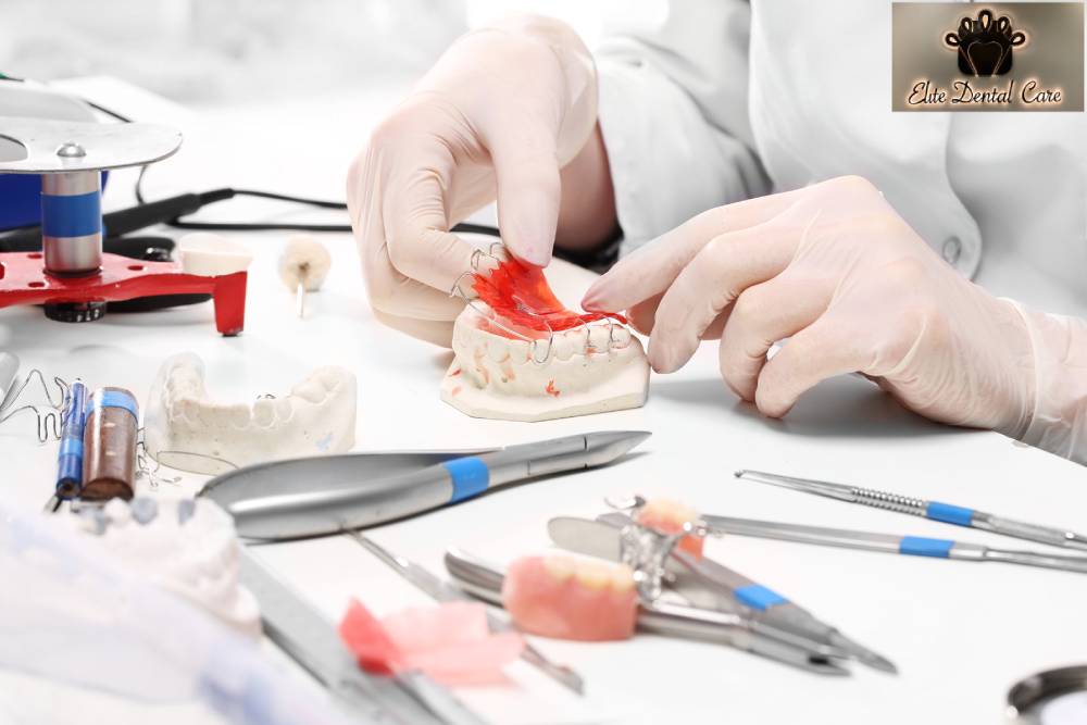 What are the different types of dentures - Elite Dental Care Tracy