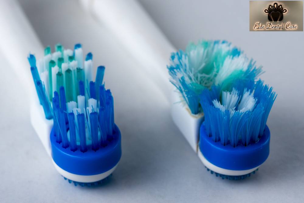 When Should You Replace Your Toothbrush – Elite Dental Care Tracy