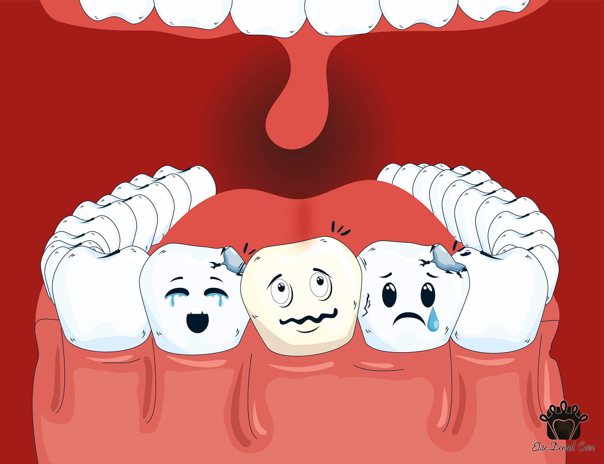 Oral Hygiene and its Importance