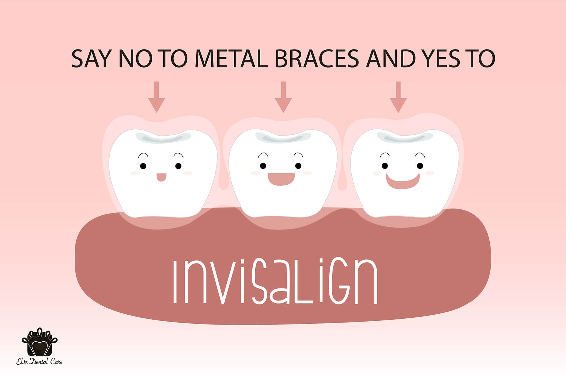 No Metal Braces!! Benefits of Invisalign – Elite Dental Care Tracy