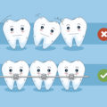 Are You Aware of Braces? Why and Who Puts on Them? – Elite Dental Care Tracy