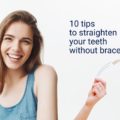 Top Ten Tips to Straighten Your Teeth Without Braces – Elite Dental Care Tracy