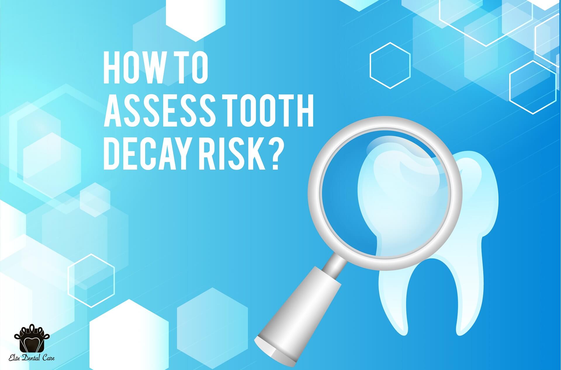 Top 5 risks assessment for tooth decay