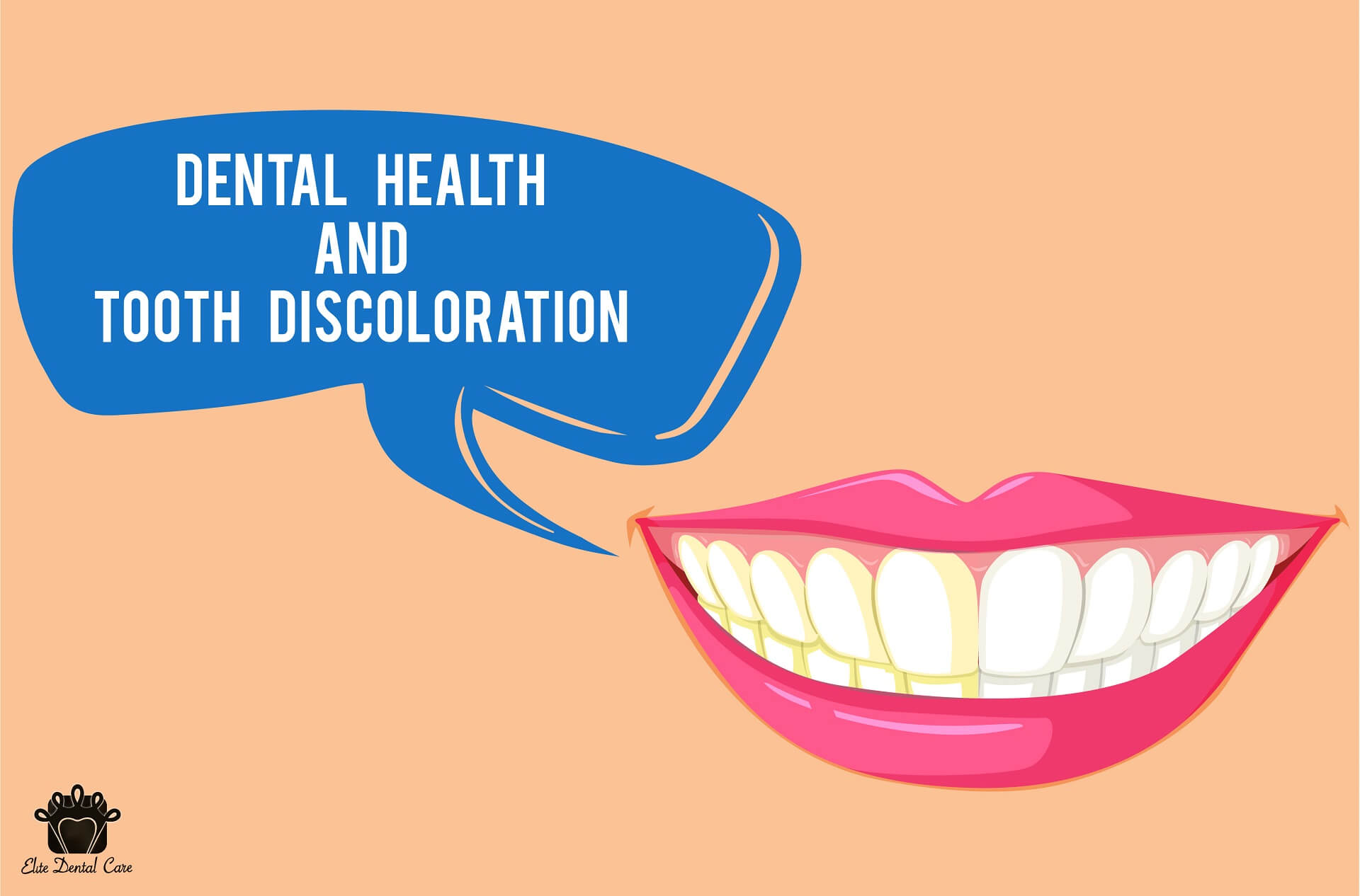 Dental health and tooth discoloration