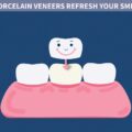 Porcelain Veneers Refresh Your Smile – Elite Dental Care Tracy