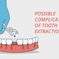 Possible Complications of Tooth Extraction – Elite Dental Care Tracy