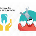 AFTERCARE FOR TOOTH EXTRACTION – ELITE DENTAL CARE TRACY