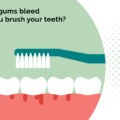 WHY DO GUMS BLEED WHEN YOU BRUSH YOUR TEETH? – ELITE DENTAL CARE TRACY