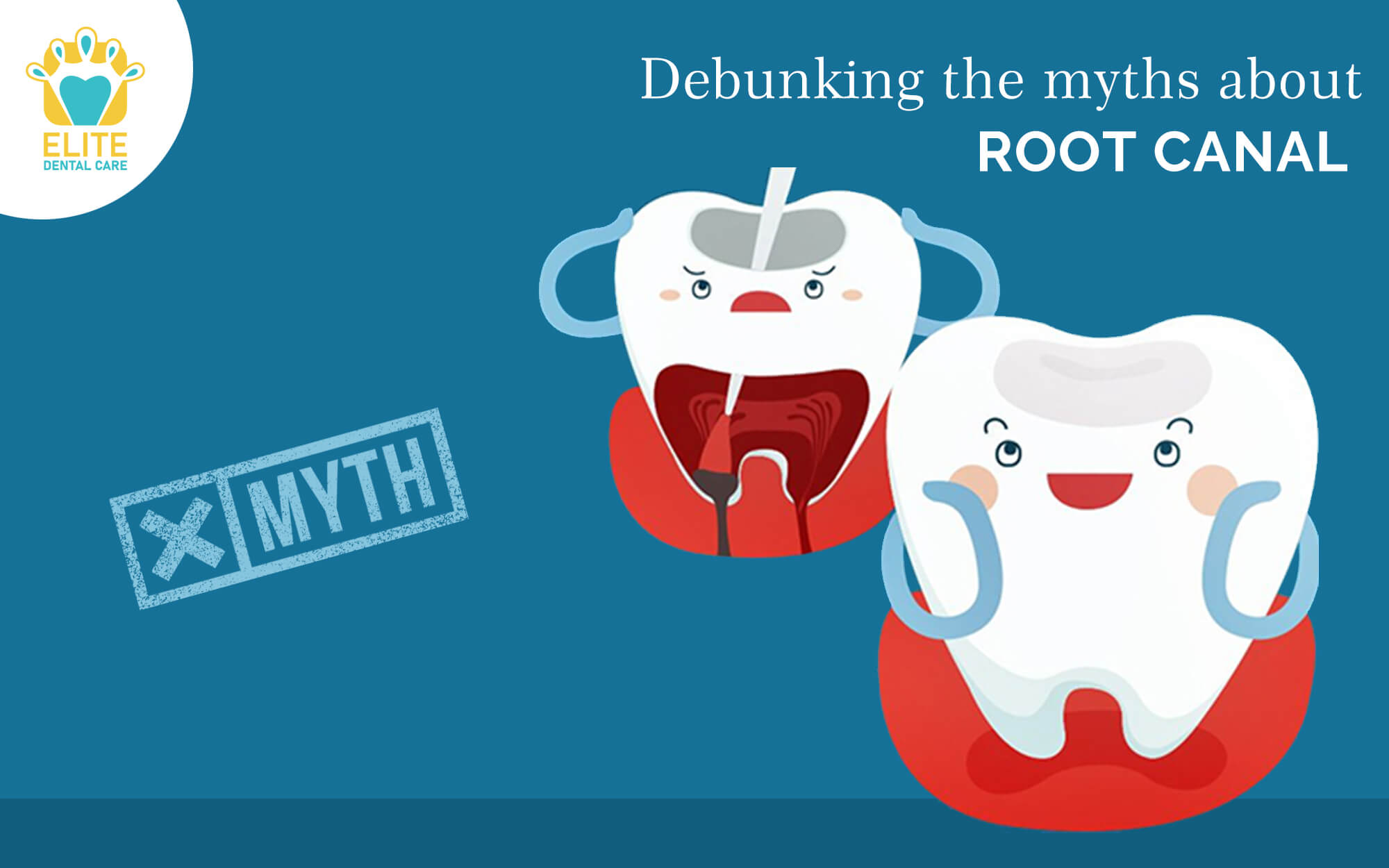 DEBUNKING THE COMMON MYTHS ABOUT ROOT CANAL TREATMENT