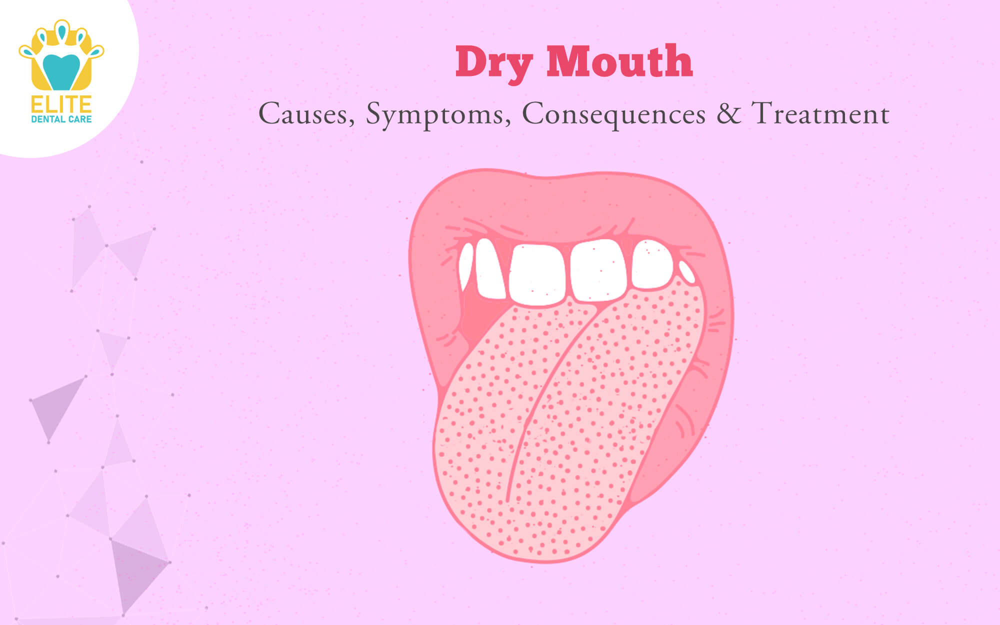 What Is Cottonmouth & Can Smoking Cause It?