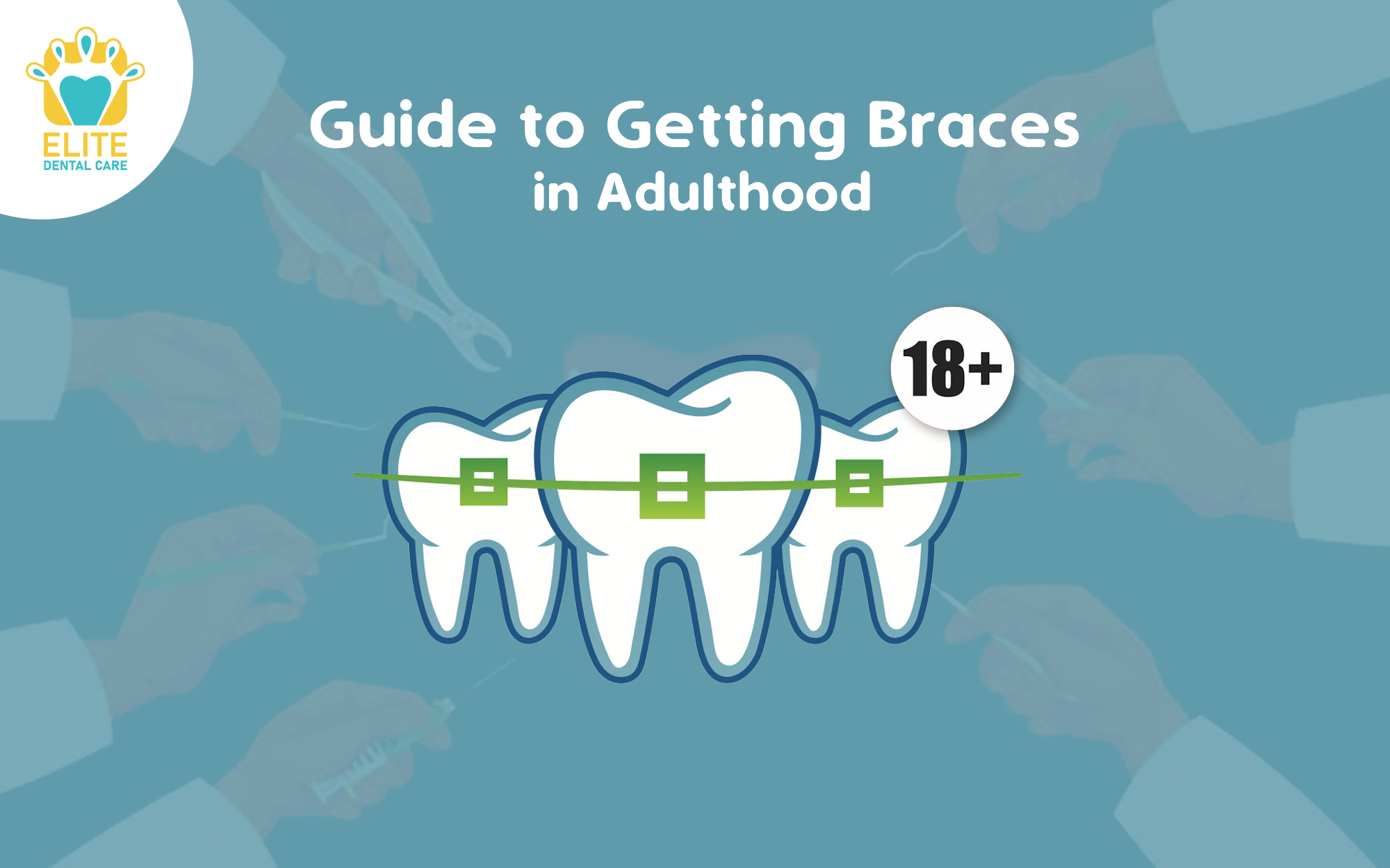 GUIDE TO GETTING BRACES FOR ADULTS