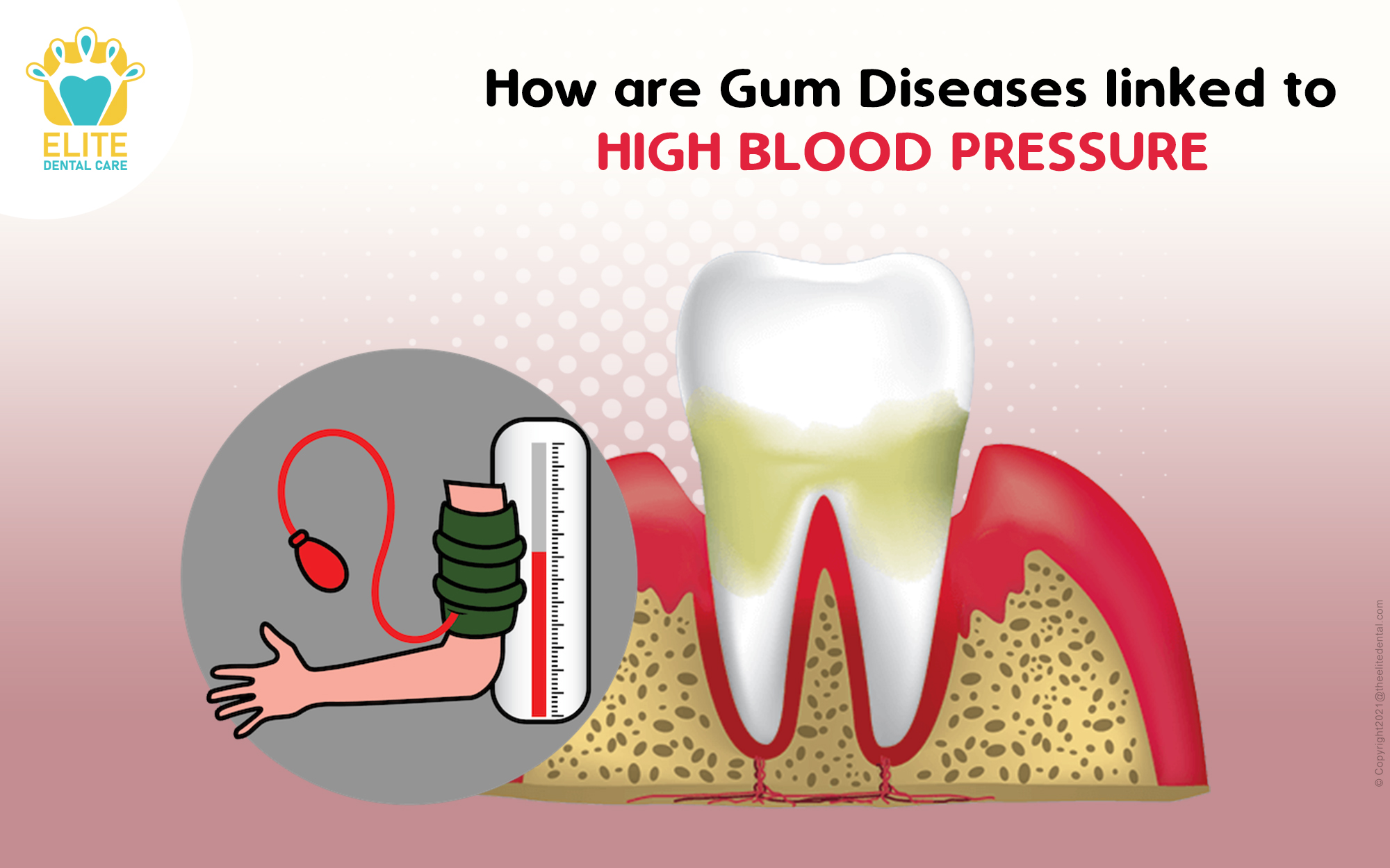 HOW ARE GUM DISEASES LINKED TO HIGH BLOOD PRESSURE