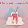 5 TIPS TO SPEED UP ROOT CANAL RECOVERY