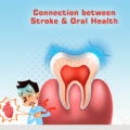 CONNECTION BETWEEN STROKE & ORAL HEALTH