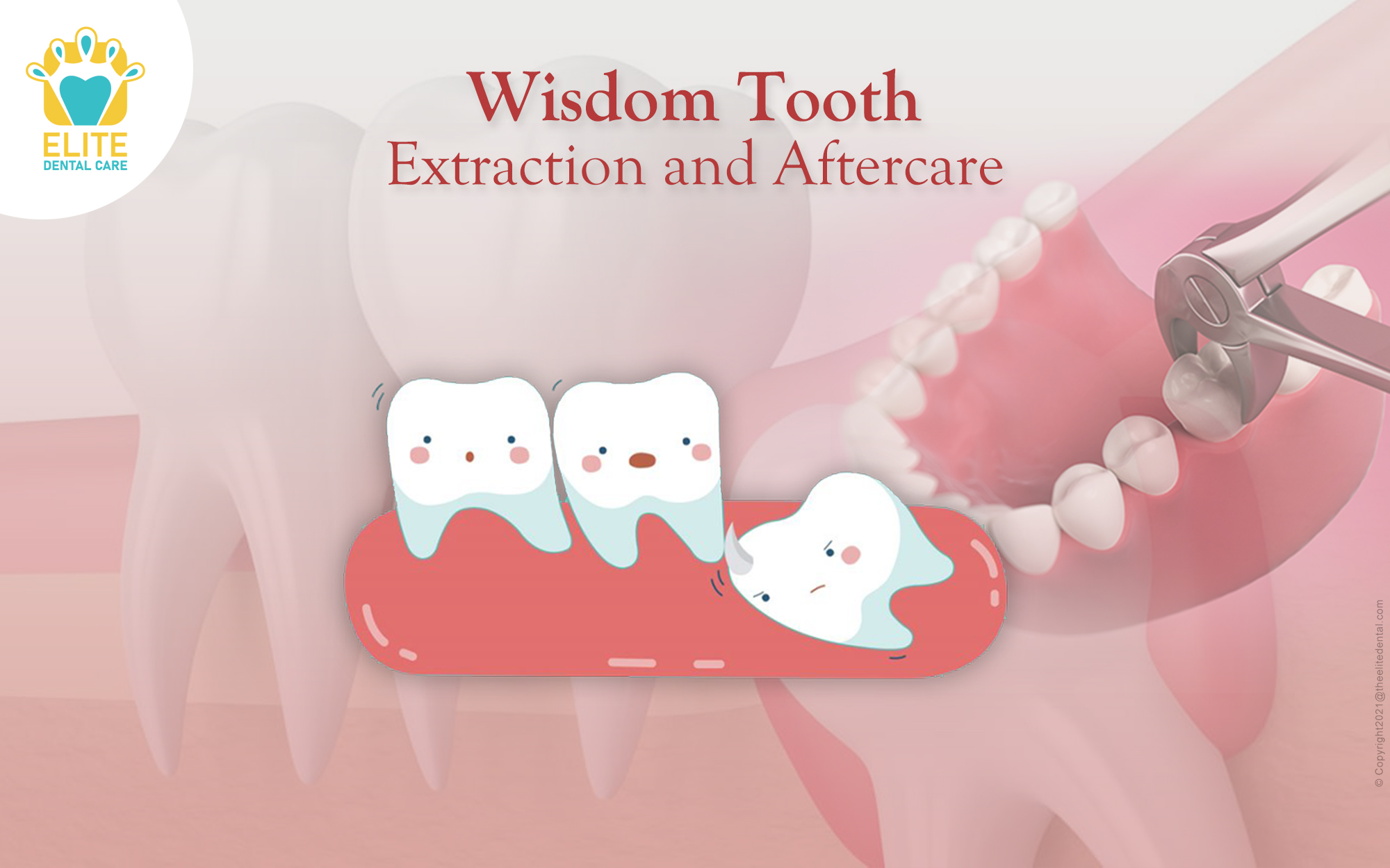 Wisdom Tooth Extraction & Aftercare: Everything You Need to Know!