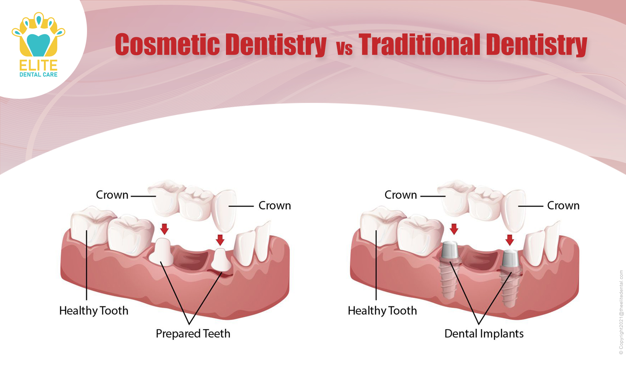 Cosmetic Dentistry Vs Traditional Dentistry