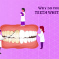 Why do you need teeth whitening?