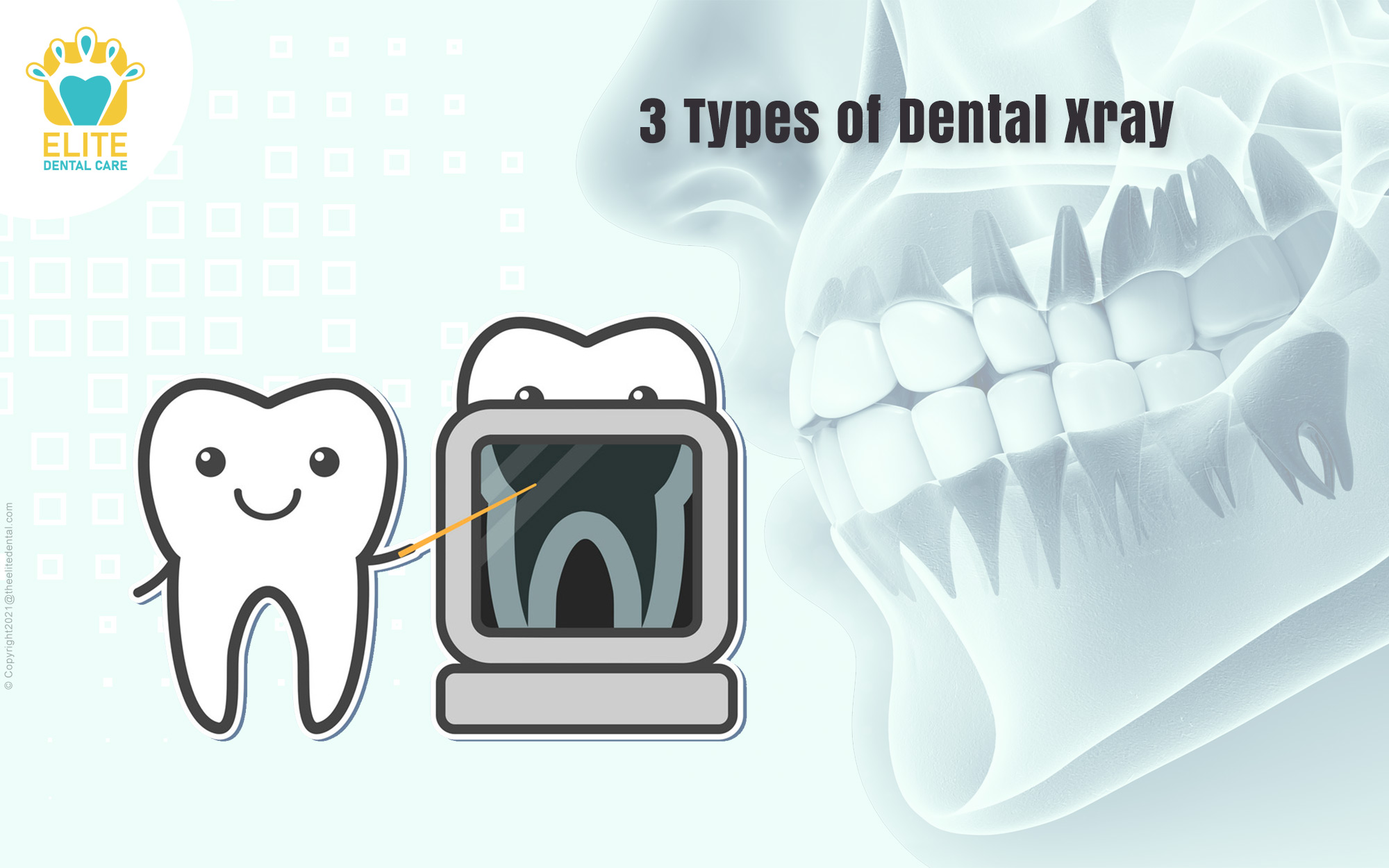 3 Types of Dental Xray