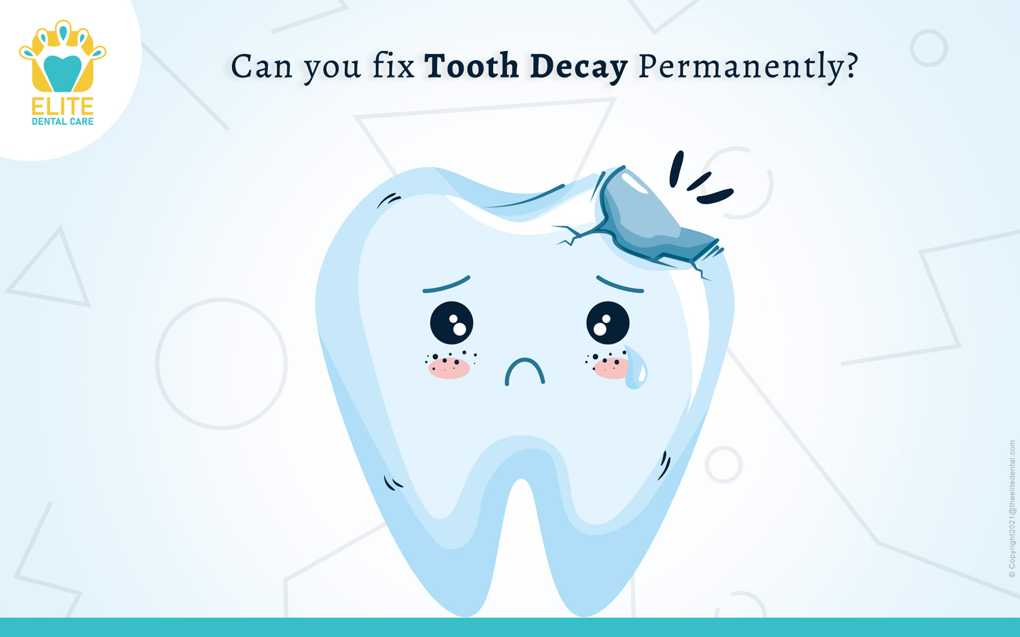 Can you fix Tooth Decay Permanently?