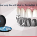 How much time does it take for Invisalign to work?