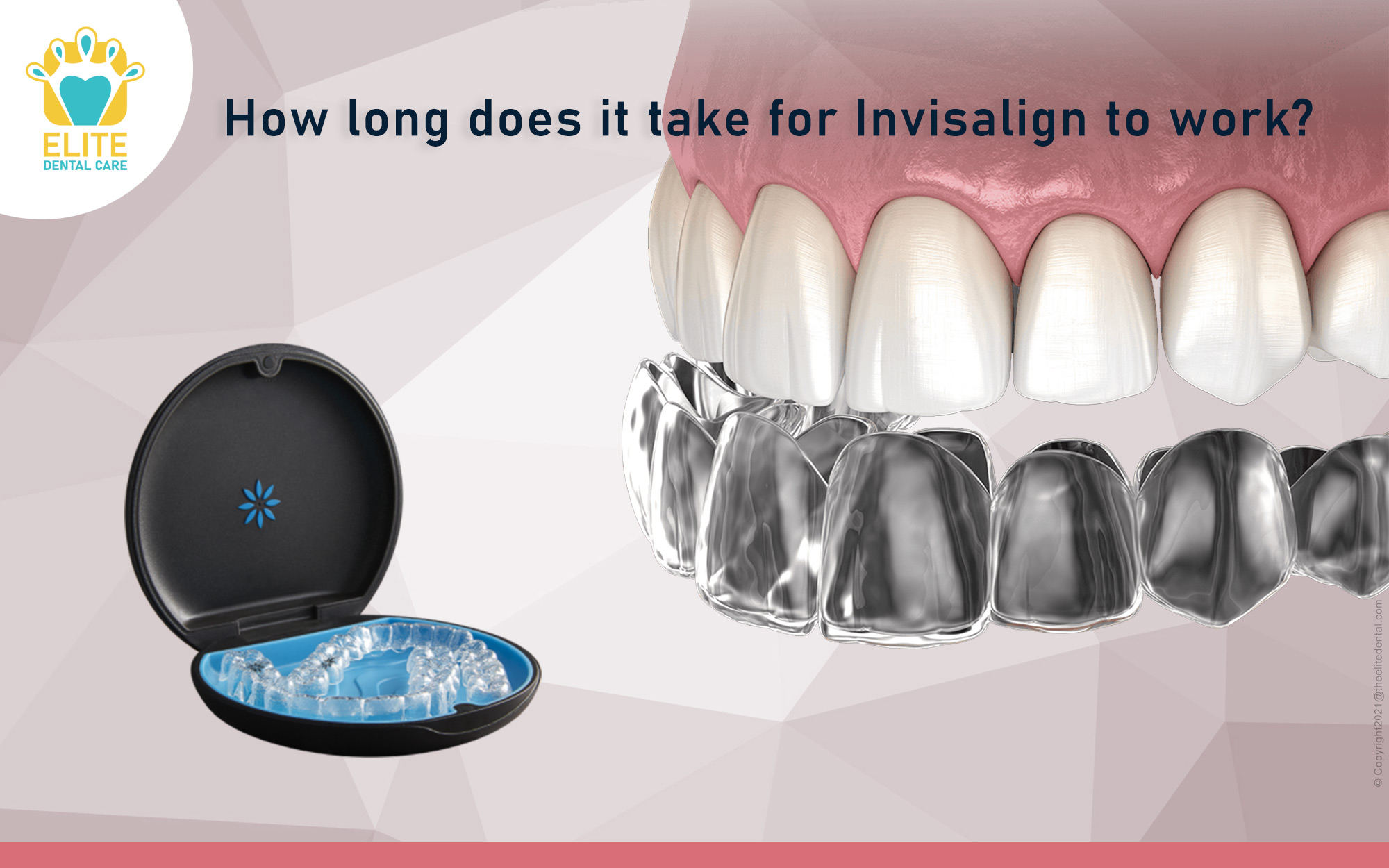How much time does it take for Invisalign to work?