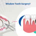 Is wisdom tooth removal a major surgery?