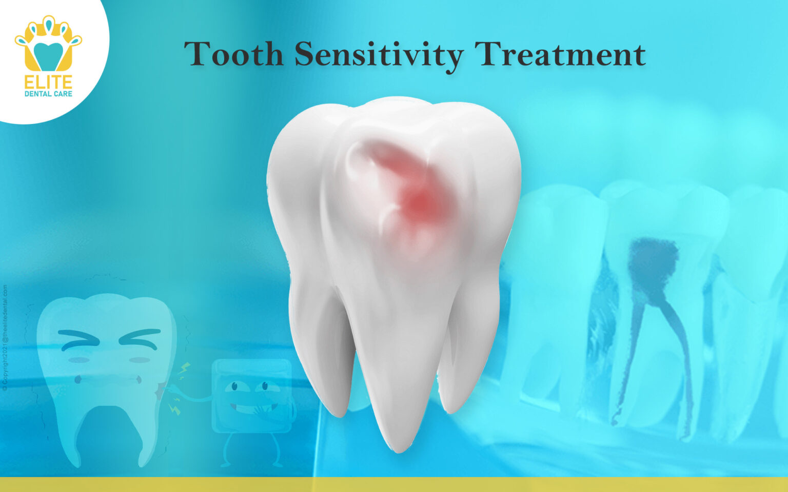 Tooth Sensitivity Treatment Causes And Treatment Elite Dental Care
