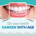 Does Your Teeth Darken with Age?