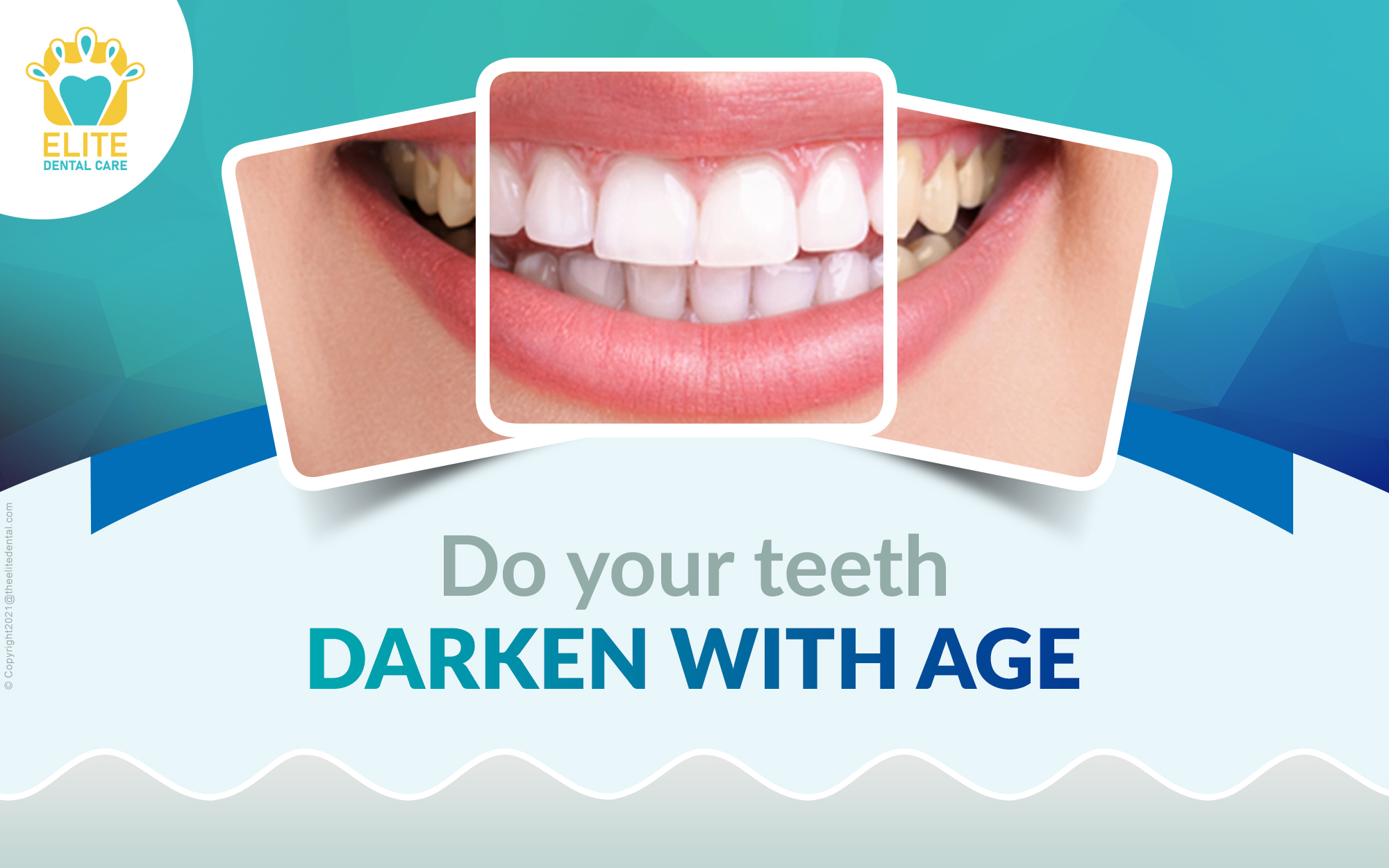 Does Your Teeth Darken with Age?