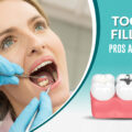 What are the Pros and Cons of Undergoing Dental Tooth Filling?
