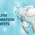 What are the Significant Benefits of Mouth Hydration?