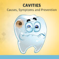 Cavities: Causes, Symptoms and Prevention