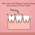 Why Some Old Fillings Could Be Doing More Harm to Your Tooth?