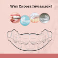Why choose Invisalign?